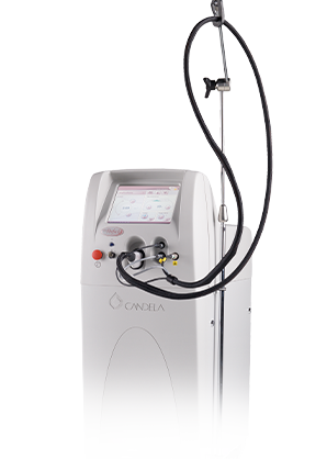 VBeam Perfecta 이미지